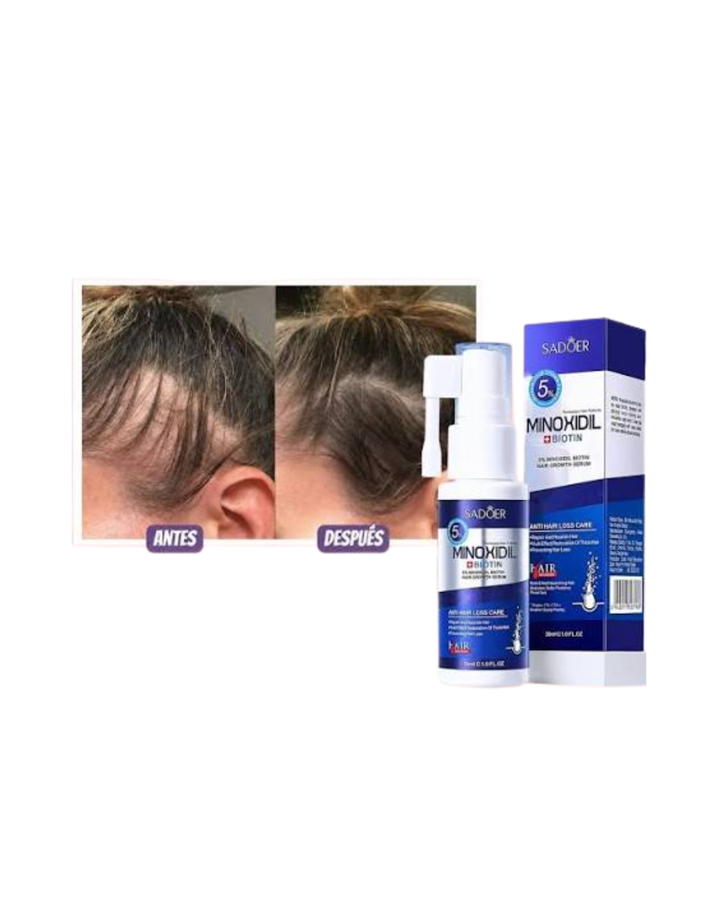 Tratamiento Anticaída Serum Capilar